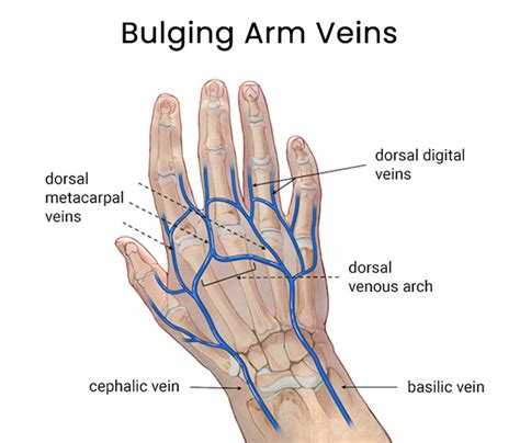 Popped Vein in Hand: Causes, Symptoms, and Treatment - A Comprehensive Guide