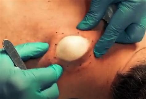 Revive Your Body's Radiance: Discover the Magic of Popping Back By Pulling Skin