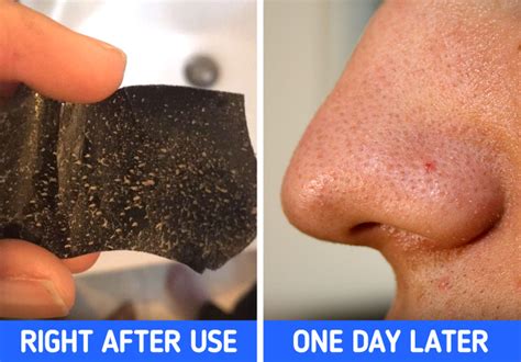 Breaking Down the Truth: Why Pore Strips Can Be Detrimental to Your Skin