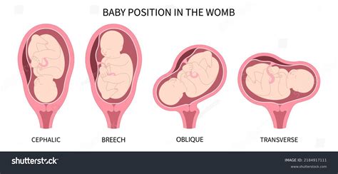 The Marvelous Journey: Unveiling the Position of Your Baby in the Womb at 20 Weeks!