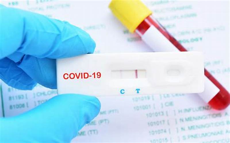 Positive Covid-19 Test