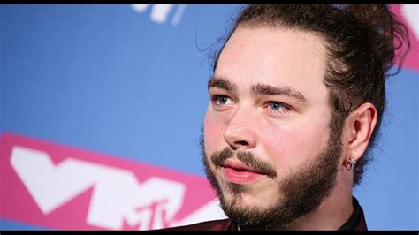 Post Malone Tattoo Removal