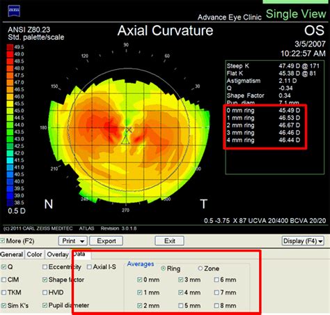 Enhance Your Vision with Our Post Refractive IOL Calculator - Accurate Results Guaranteed