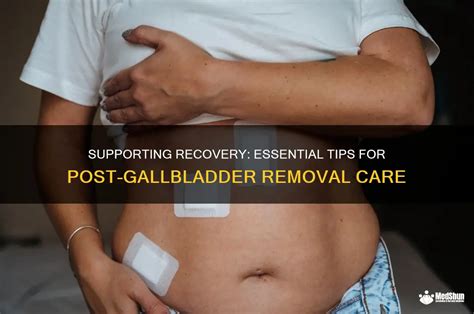 Post-Removal