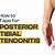 Posterior Tibial Tendonitis Swelling