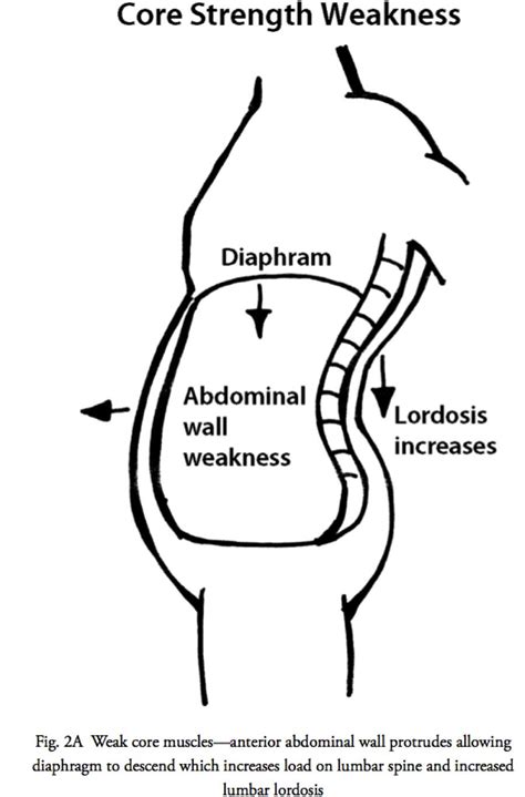 Posture and Core Weakness