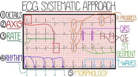 Practical Tips for ECG Analysis