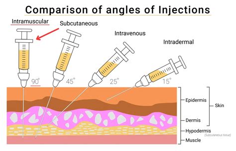Practical Tips for Managing Your Injections