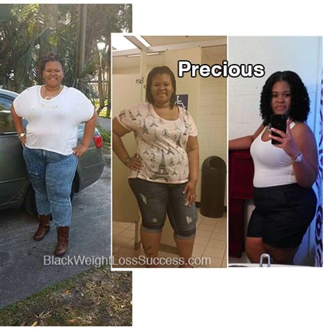 Precious Before And After Losing Weight