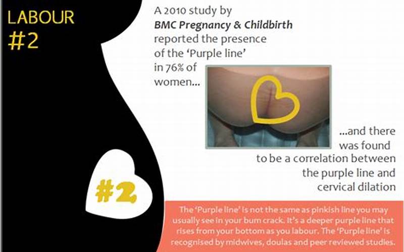 Pregnancy Purple Line Image