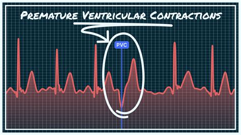 Contractions Sound