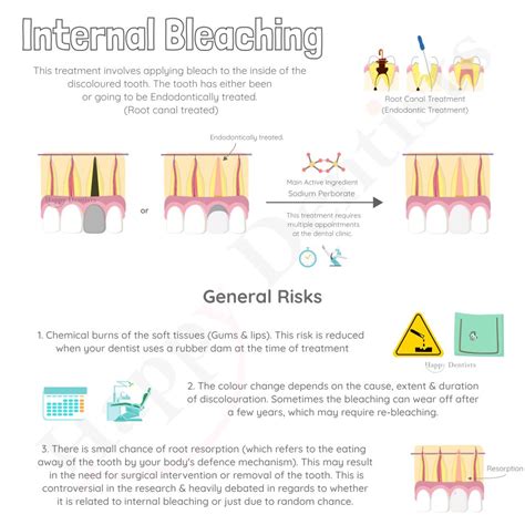 Prep Work 101: Bleaching is Non-Negotiable