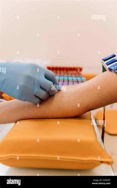 Preparing for Your Blood Draw