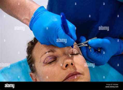 Preparing for Your Eye Procedure