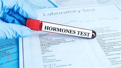 Preparing for Your Hormone Test