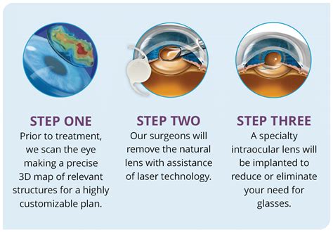 Preparing for Your Lens Eye Procedure