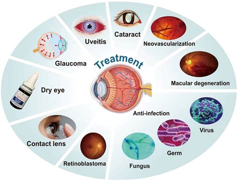 Illustration depicting cataracts