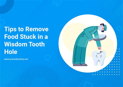 Preventing Food from Getting Stuck in Wisdom Tooth Holes
