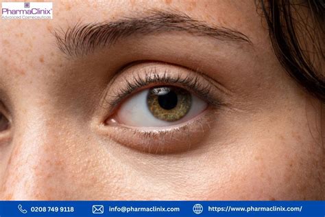 Preventing Future Hyperpigmentation Around Eye Issues