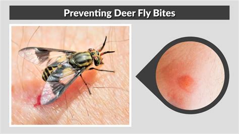 Preventing deer fly encounters