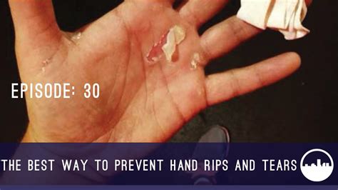 Preventive measures to avoid further rips and tears