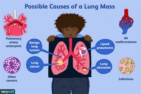 Primary Causes of Lung Cancer