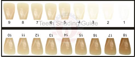 Printable Tooth Shade Chart