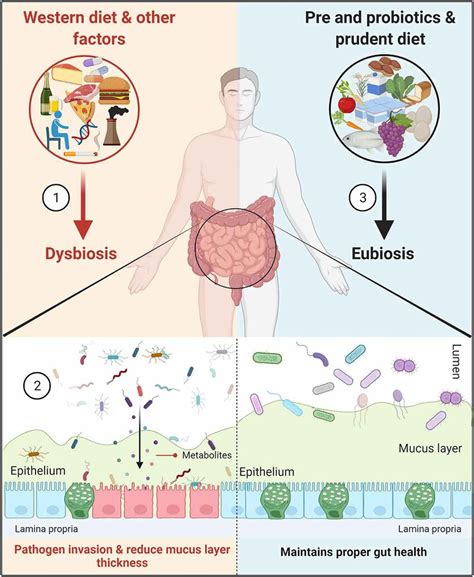 Probiotics and Metabolism