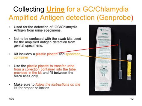 Procedure for GC Chlamydia Urine Test