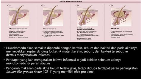 Produksi Sebum Berlebihan