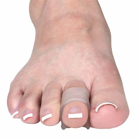 Professional Help for Hammer Toes