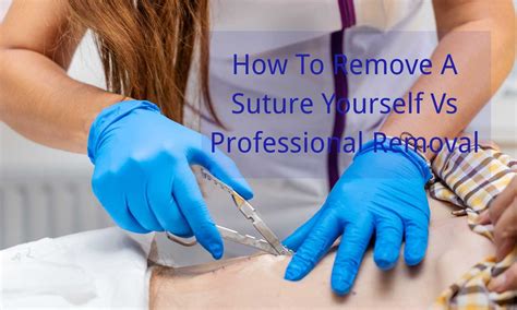 Professional Removal Options