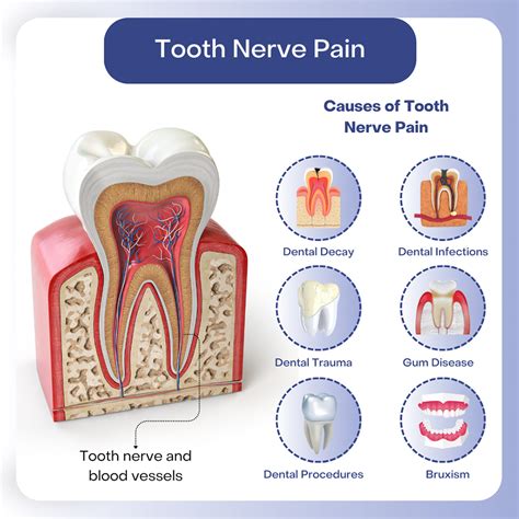 Professional Ways to Address a Tooth Nerve Problem