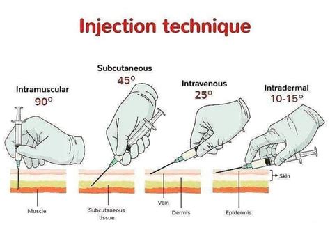 Proper Injection Techniques