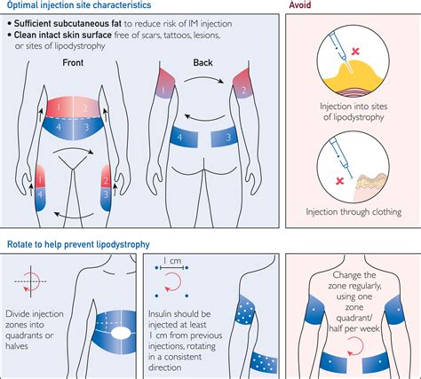 Proper Injection Technique and Site Rotation