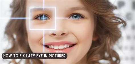 Proven Methods on How To Fix A Lazy Eye