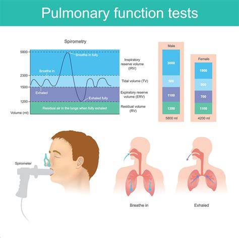 Pulmonary Function Test Results Chart