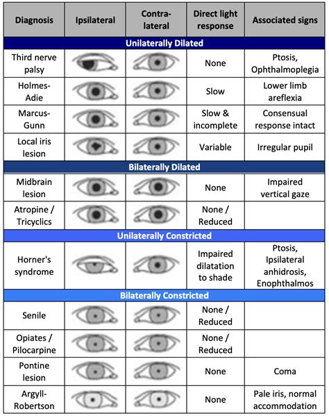 Pupil Abnormalities: Spot the Warning Signs.
