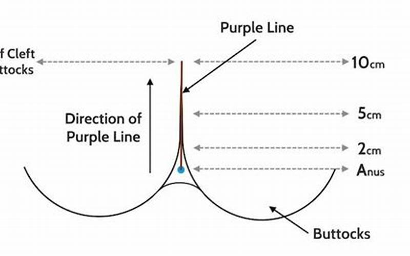 Purple Line Dilation Image Indication