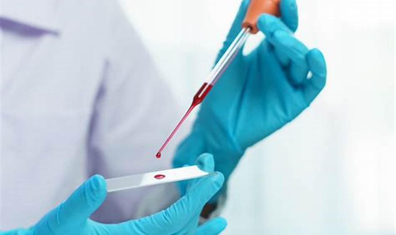 Purpose significance blood tests