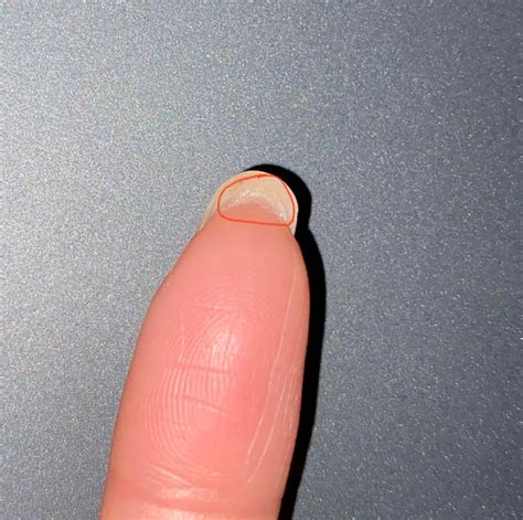 Under the Skin: The Shocking Truth About Pushing Fake Nails Beyond the Surface