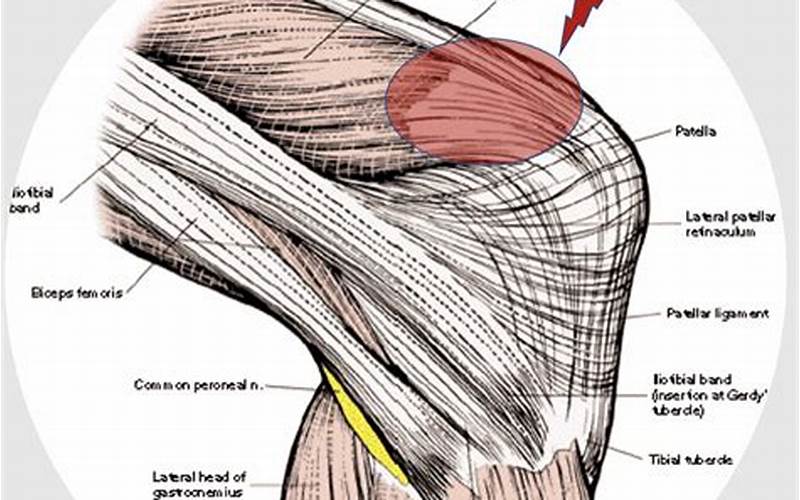 Kt Tape for Quadriceps Tendonitis: A Comprehensive Guide
