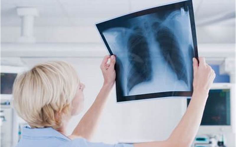 Qualifications For Travel Xray Jobs