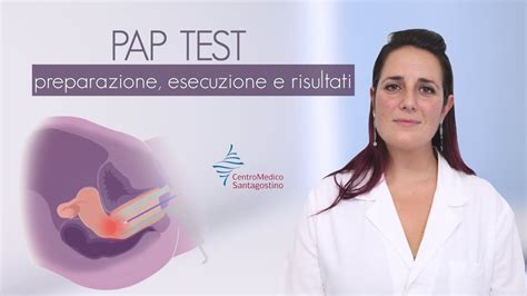 Pap test le 10 domande più frequenti delle pazienti Gemelli Curae
