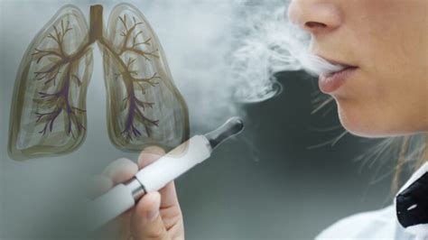 Quitting Vaping Lung Recovery