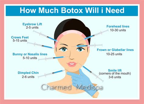 Range of Botox units