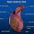 Rat Dissection Heart