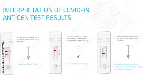 Mastering the Art of Decoding Covid-19 Test Results: A Comprehensive Guide to Reading Your Test Results with Ease!