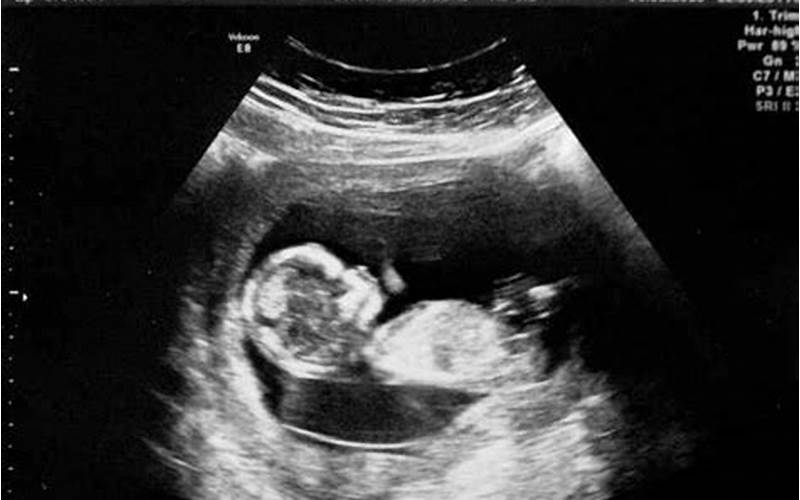 Real Ultrasound Images