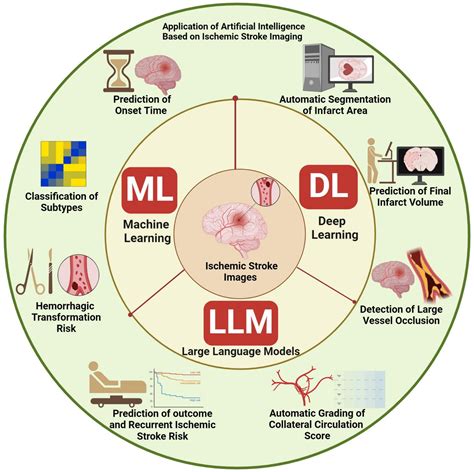 Real-World Applications of Ischemic Stroke Knowledge